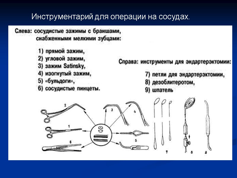Инструментарий для операции на сосудах.